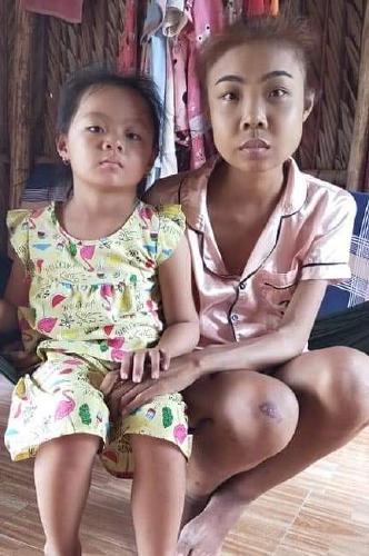 Cùng chia sẻ một hoàn cảnh bệnh tật khó khăn