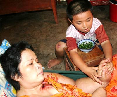 Nghẹn lòng trước cảnh con 5 tuổi chăm mẹ bị ung thư