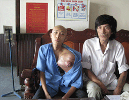 Học hành dang dở vì mắc bệnh hiểm nghèo 